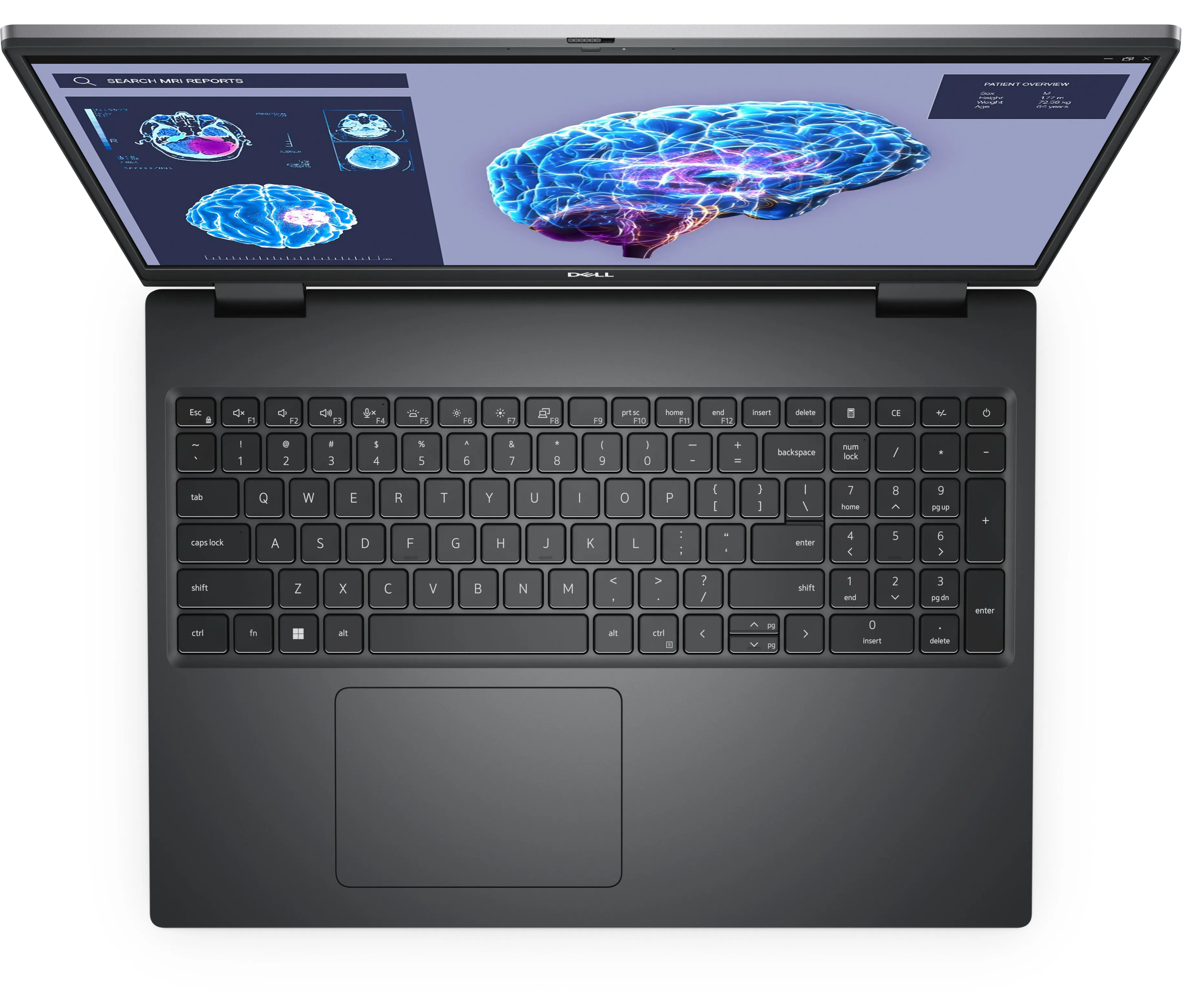 Dell Precision 7680 - Intel Core I7 - 13850Hx / Up To 5.3 Ghz - Win 11 Pro - Nvidia Rtx 3500 Ada - 32 Gb Ram - 1 Tb Ssd